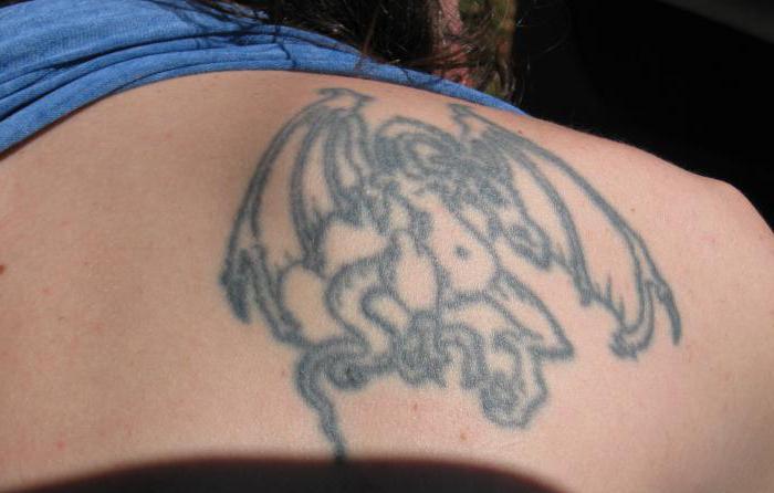 Je li moguće smanjiti neuspješne tetovaže? Svi načina da se riješite dosadne ili ružne tetovaže