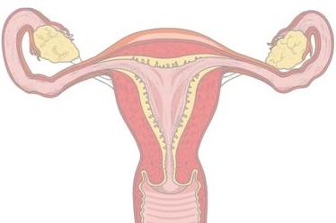 Kako zaustaviti krvarenje kod menstruacije kod kuće?